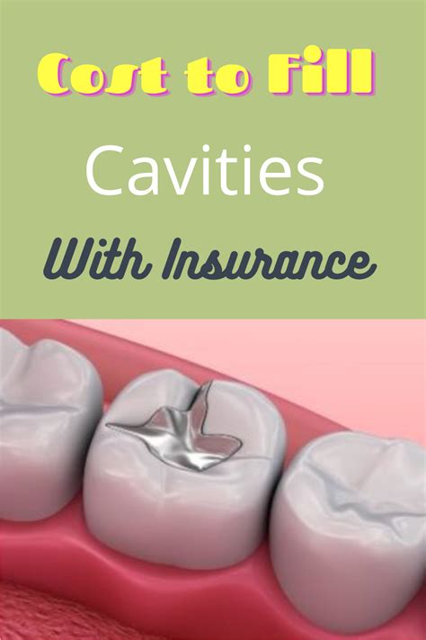 Affordable Cavity Filling Cost without Insurance―Your Ultimate Guide